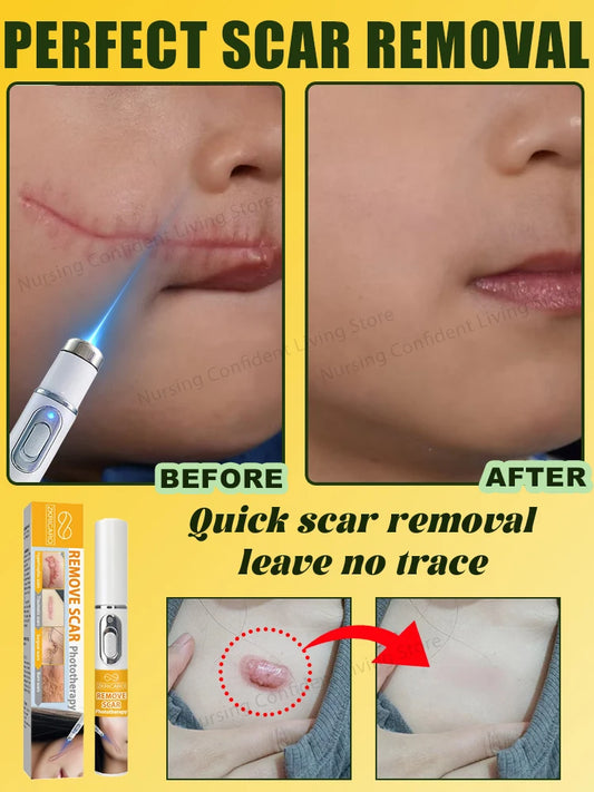 Laser Scar Removal Brush – Fast & Non-Electric Skin Rejuvenation Tool