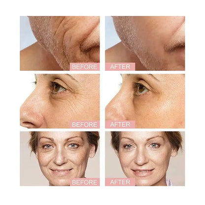 Ginseng Snail Repair Serum – Anti-Wrinkle & Brightening