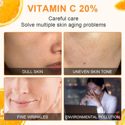 JoyPretty Vitamin C Whitening Face Set – 5PCS Skincare Kit