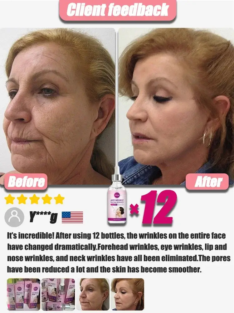 Skin Firming Serum - Anti-Aging Skin Essence