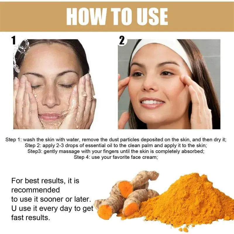 Turmeric Freckle Whitening Serum – Dark Spot Remover