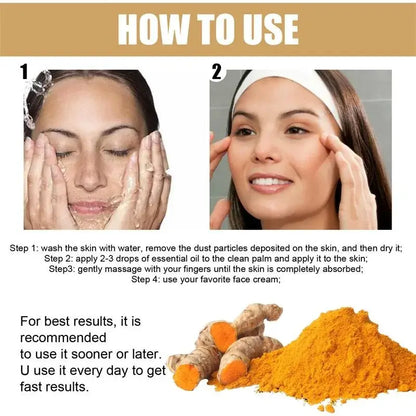 Turmeric Freckle Whitening Serum – Dark Spot Remover