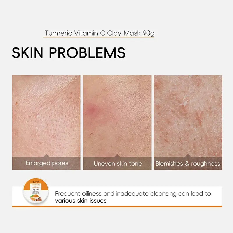 Turmeric & Vitamin C Mud Mask – Clarifies & Fights Acne