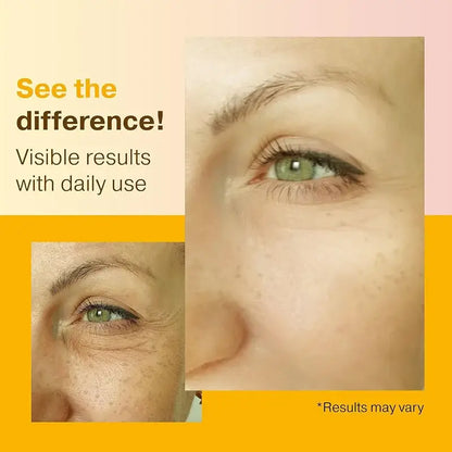 2pcs Vitamin C Serum for Face & Eyes – Brightening & Hydrating