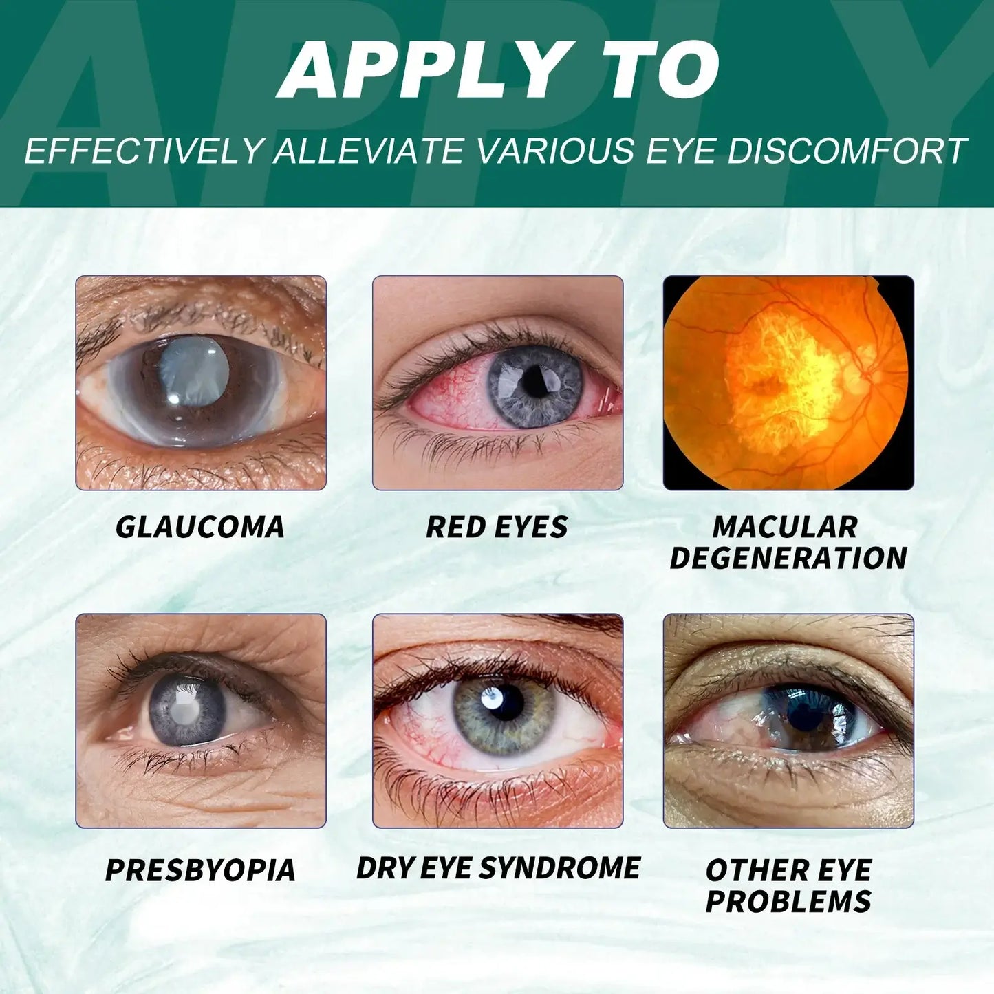 Vision-Enhance Eye Serum Roller – Reduce Dark Circles & Puffiness