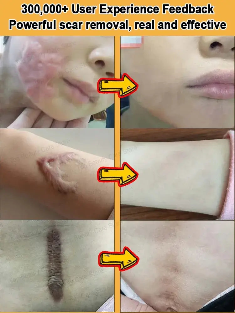 Laser Scar Removal Brush – Fast & Non-Electric Skin Rejuvenation Tool