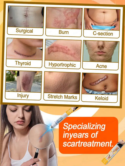 Laser Scar Removal Brush – Fast & Non-Electric Skin Rejuvenation Tool