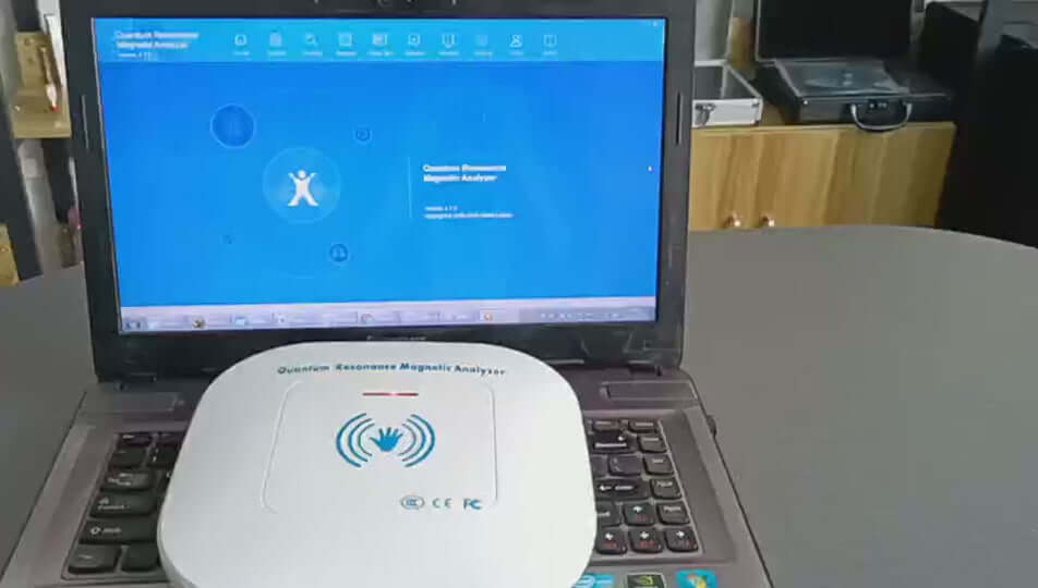 QMR-998 Quantum Resonance Analyzer – Sub-Health Diagnostic Scanner